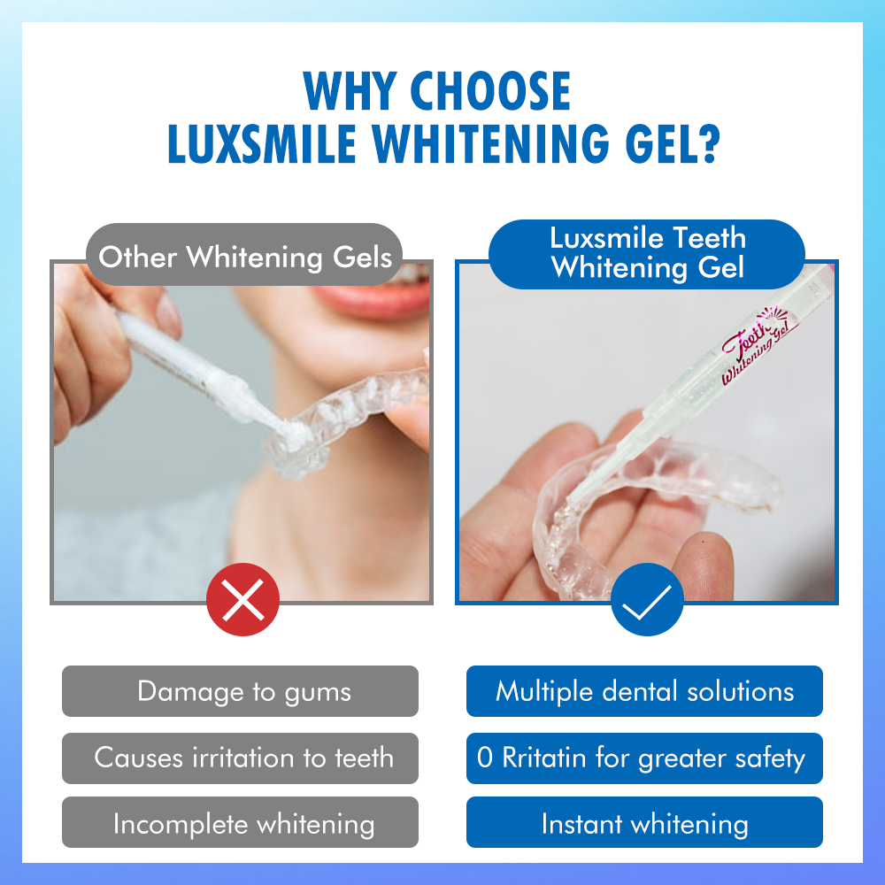 치아 미백 젤 PAP 또는 35%CP 치아 미백 젤 구 - Teeth Whitening Ulta 리뷰 및 가격