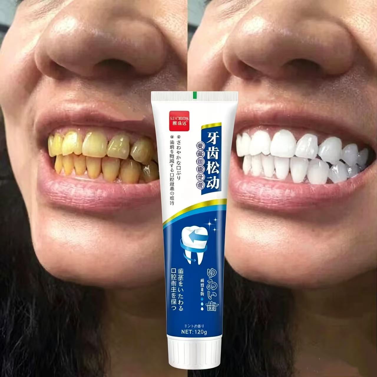 느슨한 치아를 고치는 일본 수입 치약, 성인용 연중 구 - Teeth Whitening Japanese 리뷰 및 가격