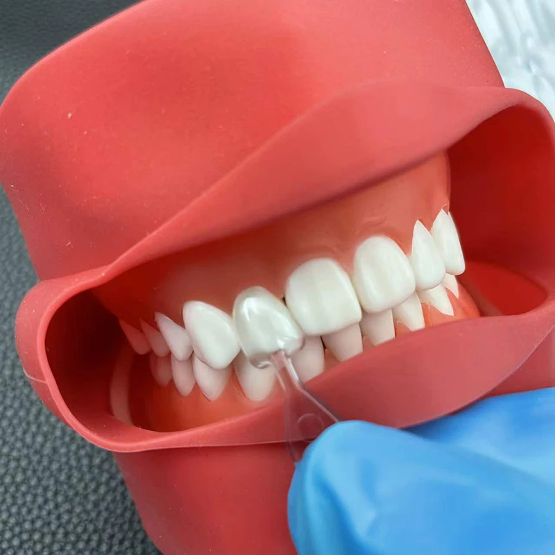 1세트/3세트/5세트 치과용 베니어 몰드 미용 베니어  - Teeth Whitening Moulds 리뷰 및 가격