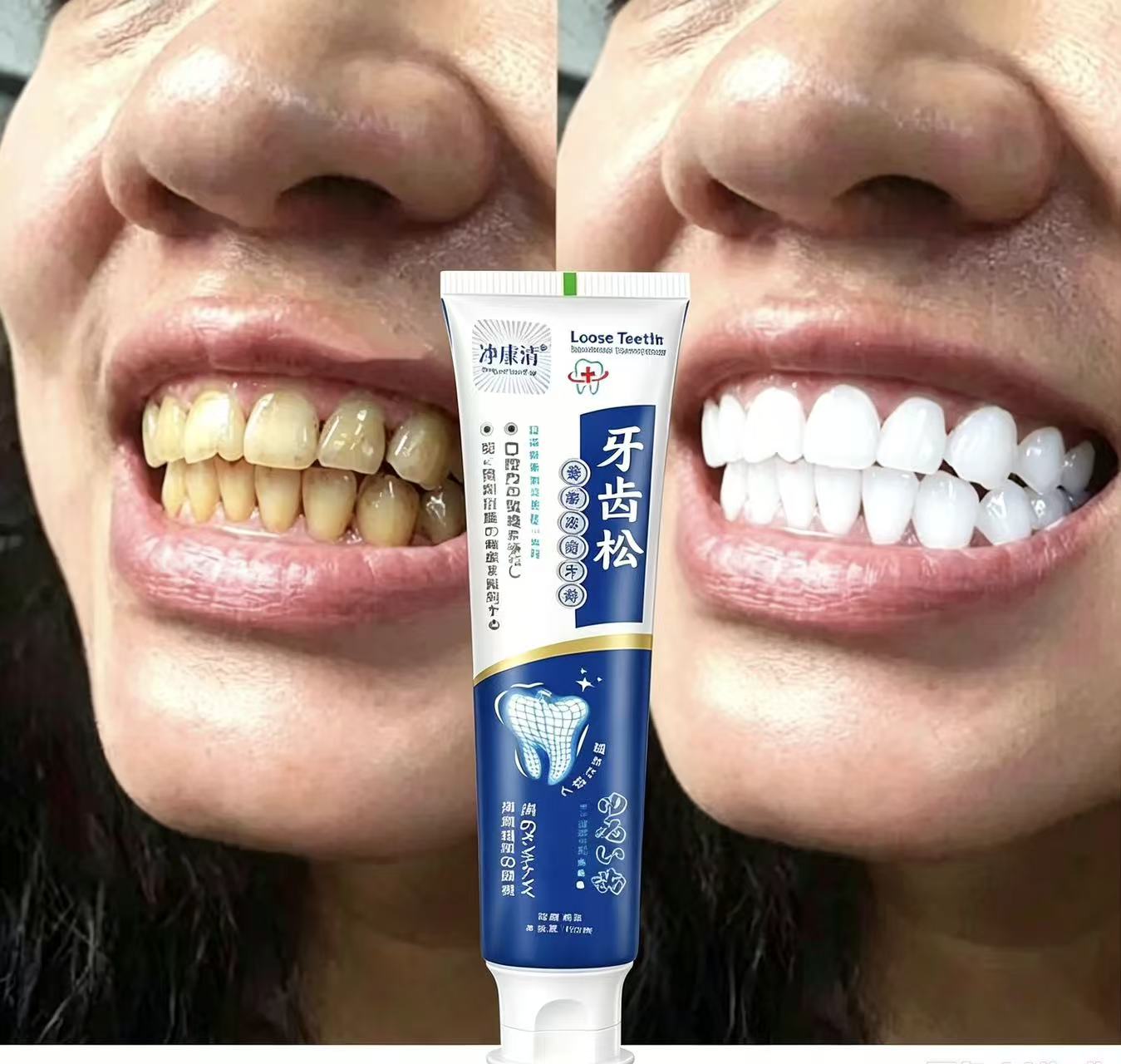 느슨한 치아를 고치는 일본 수입 치약, 성인용 연중 구 - Teeth Whitening Japanese 리뷰 및 가격