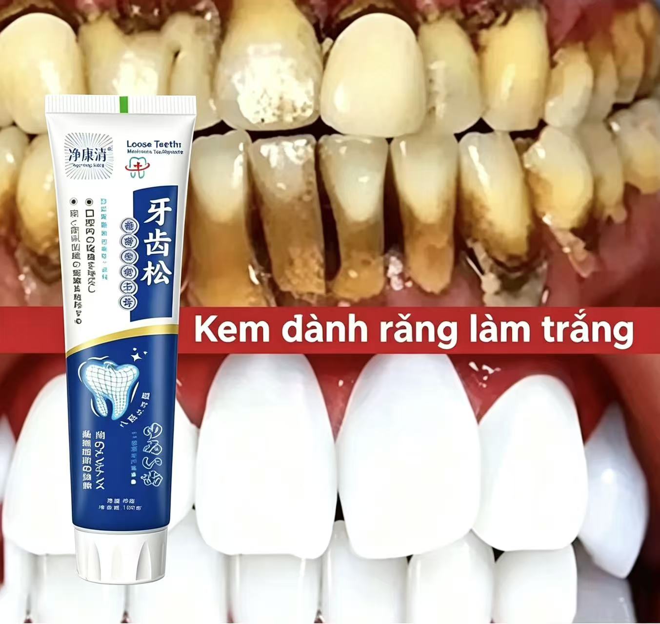 느슨한 치아를 고치는 일본 수입 치약, 성인용 연중 구 - Teeth Whitening Japanese 리뷰 및 가격