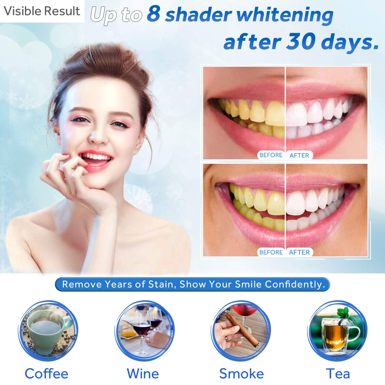 치아 미백 젤 리필 주사기 치아 미백 젤 인비스알라인  - Teeth Whitening Ulta 리뷰 및 가격