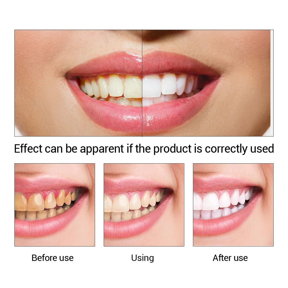 FTEENPLY 치아 미백 에센스 파우더 구강 위생 청 - Teeth Whitening Ulta 리뷰 및 가격