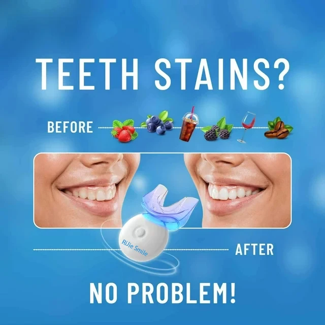 고품질 무선 치아 미백 키트, 가정용 치아 미백 키트 - Teeth Whitening At Home Kit 리뷰 및 가격