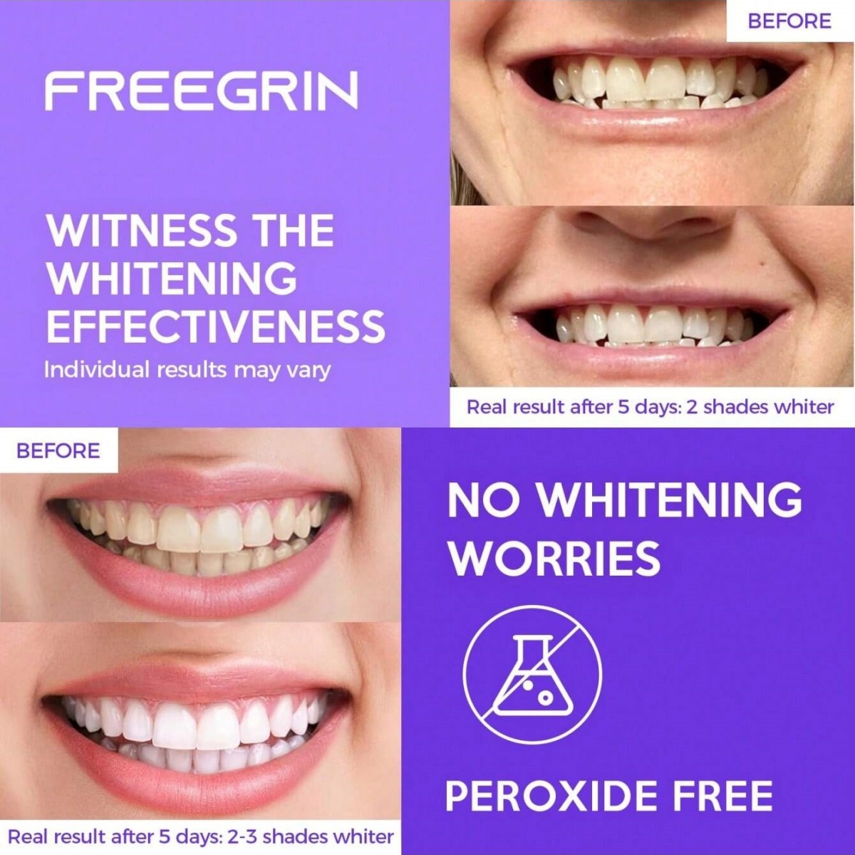 디럭스 화이트닝 치아 스티커 7/14/21 쌍 젤 화이 - Teeth Whitening Before And After 리뷰 및 가격