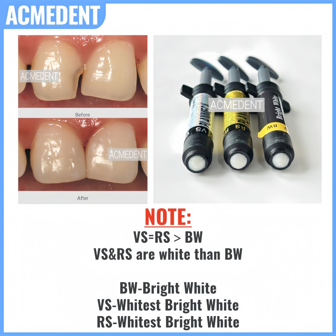 4.5g 치과용 복합 레진 베니어 광중합 밝은 흰색 하 - Teeth Whitening Vs Veneers 리뷰 및 가격