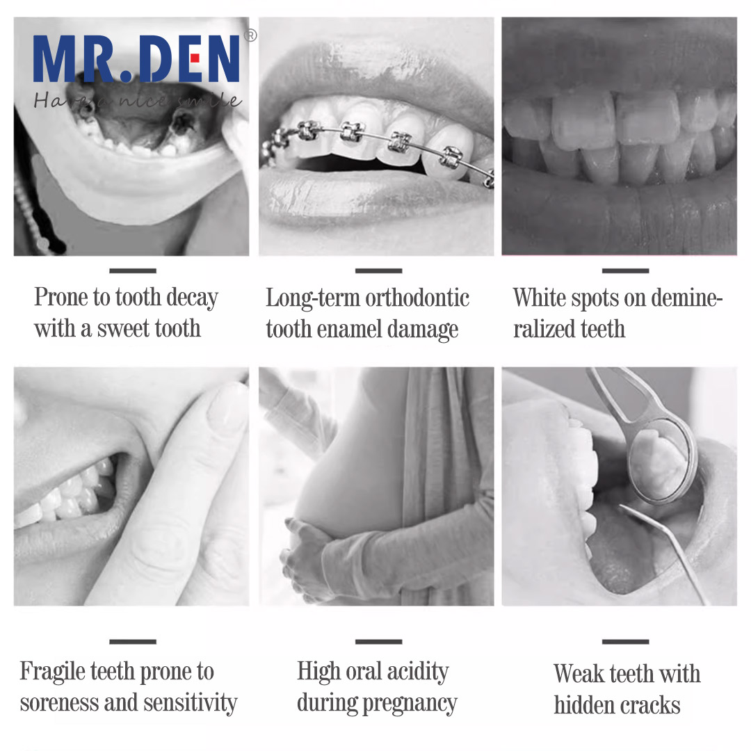 일본 GC 불소 강화 치과 치료, 비불소 치과 치료,  - Teeth Whitening In Japan 리뷰 및 가격